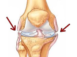 Механизм разрыва связок коленного сустава, симптомы и лечение патологии